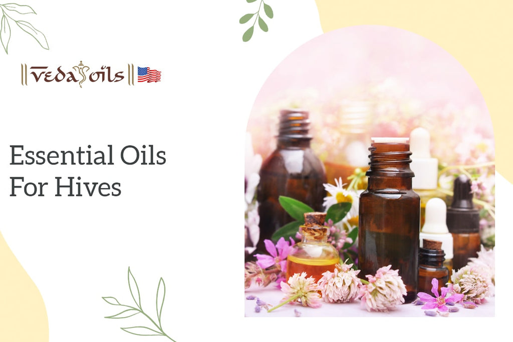 5 Best Essential Oils for Hives Treatment How to Use VedaOils USA
