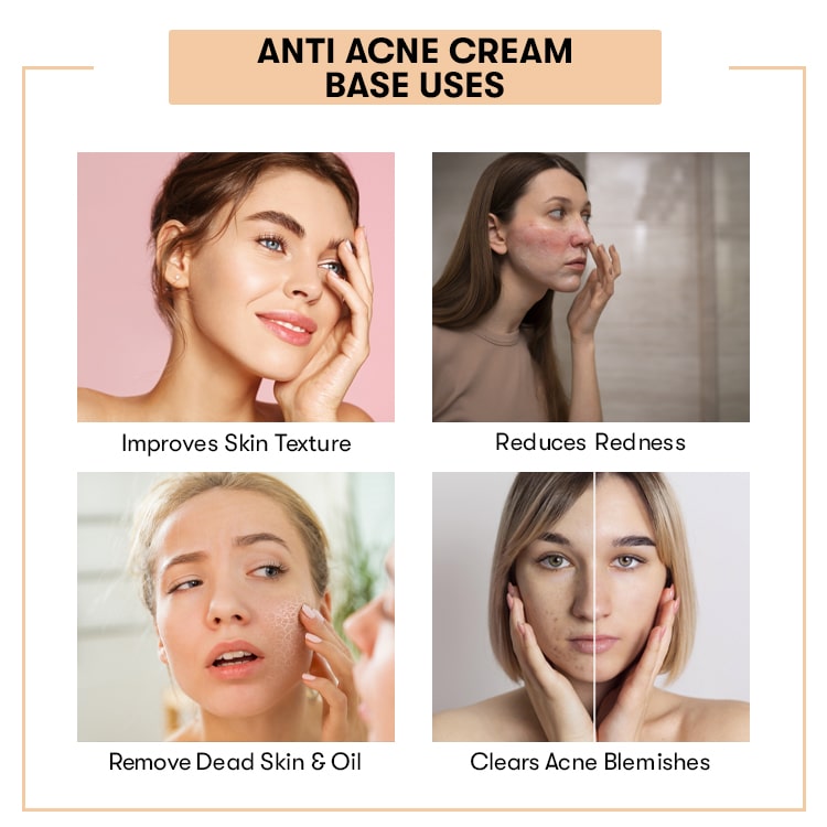 Anti Acne Cream Base ( Ready to Use )