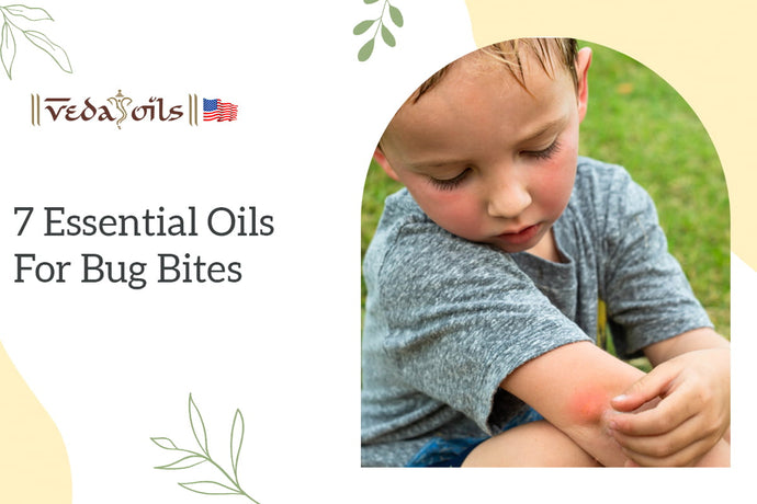7 Essential Oils for Bug Bites & How To Use It