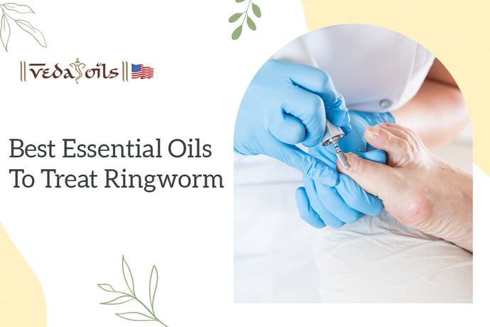 5 Best Essential Oils for Ringworm: How to Use Them
