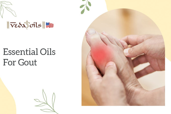 How To Treat Gout Pain Using Essential Oils