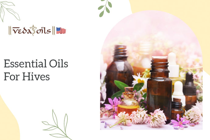 5 Best Essential Oils for Hives: How to Use