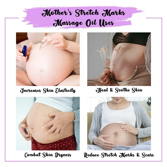 Mother's Stretch Mark Oil